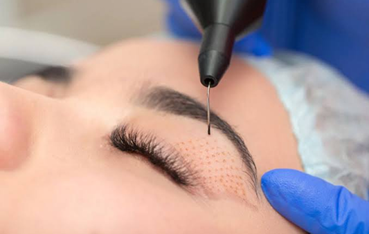 Advanced skin tightening treatment
